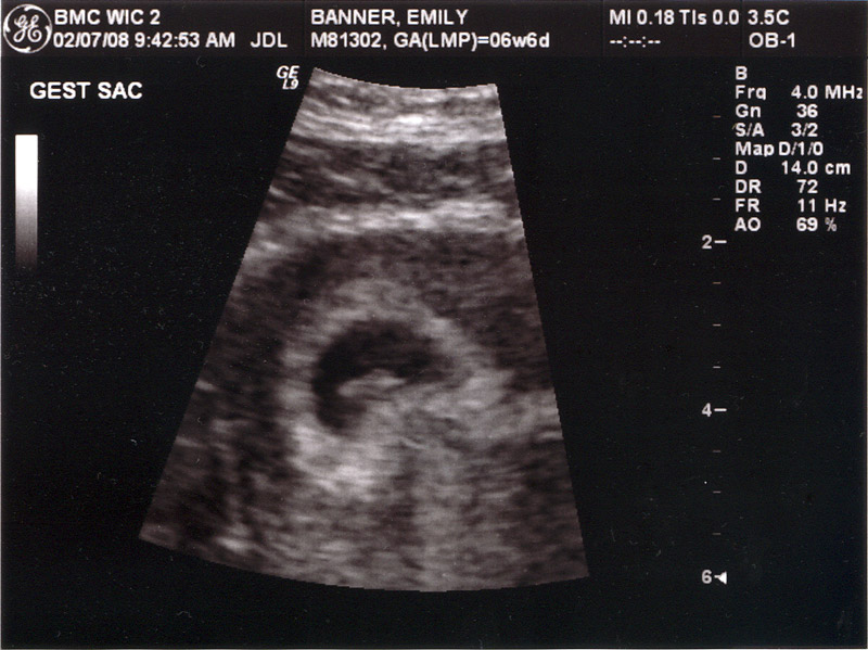 The new Baby model... from GE!